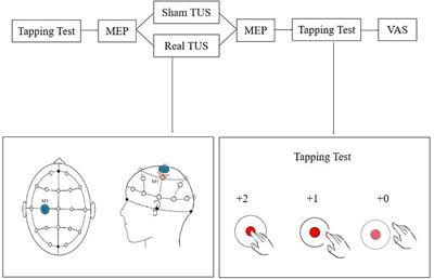 Low-intensity transcranial ultrasound stimulation facilitates hand motor function and cortical excitability: A crossover, randomized, double blind study